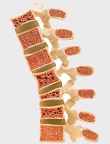 Osteoporose besiegen